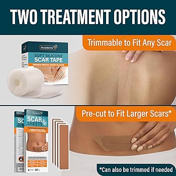 Amazon.com: NUVADERMIS Silicone Scar Sheets - Extra Long Scar
